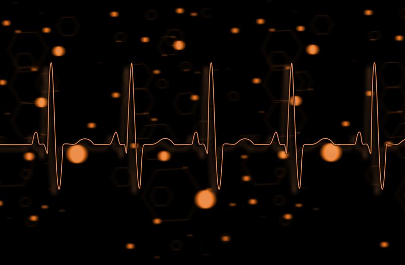 Orange ECG line