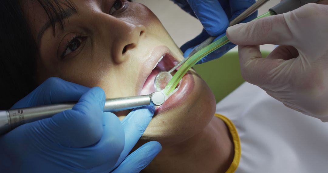 Close-up of Patient Receiving Dental Treatment from Dentist - Free Images, Stock Photos and Pictures on Pikwizard.com