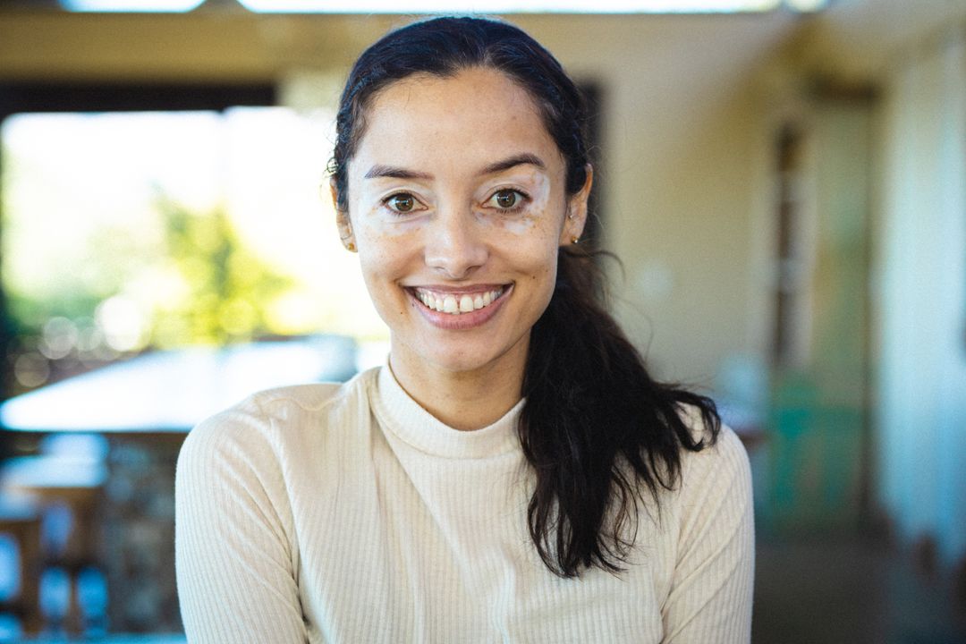 Close-up portrait of confident smiling biracial young woman suffering from vitiligo - Free Images, Stock Photos and Pictures on Pikwizard.com