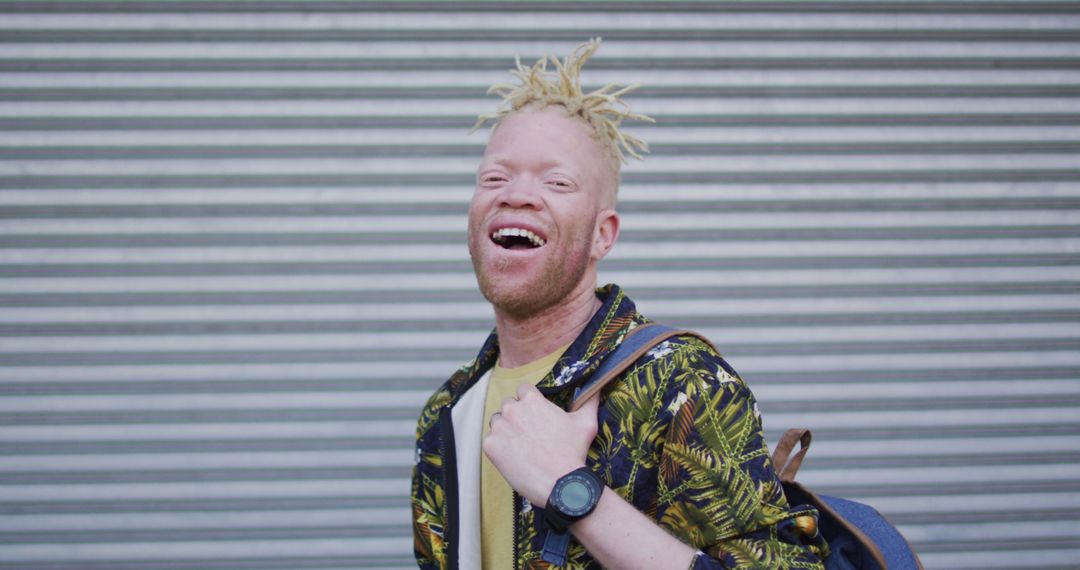 Smiling Albino African American Man with Dreadlocks