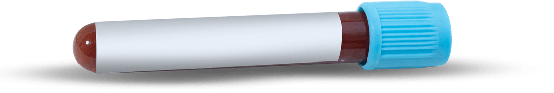 Transparent Test Tube with Blood Sample and Blue Cap Close-Up