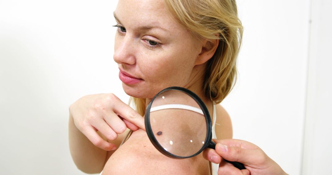 Woman With Mole On Shoulder Being Examined By Specialist - Free Images, Stock Photos and Pictures on Pikwizard.com