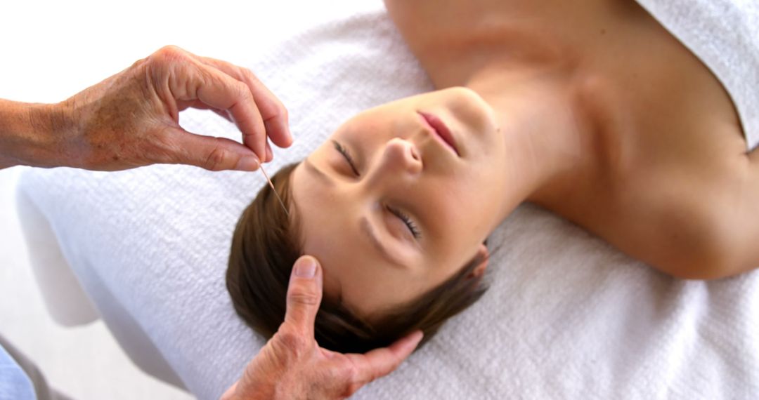 Woman Receiving Acupuncture Treatment on Forehead - Free Images, Stock Photos and Pictures on Pikwizard.com