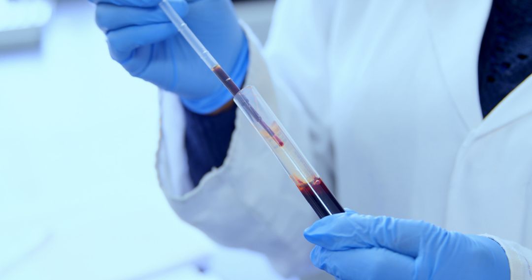 Scientist Handling Blood Sample Test Tube in Laboratory - Free Images, Stock Photos and Pictures on Pikwizard.com