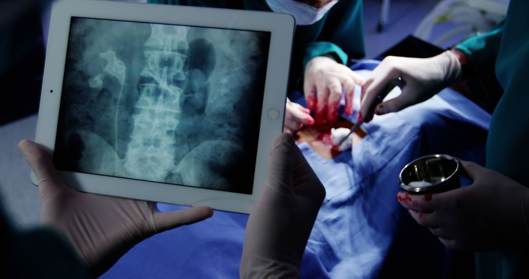 Surgeons Performing Spinal Surgery with Tablet displaying X-Ray - Free Images, Stock Photos and Pictures on Pikwizard.com