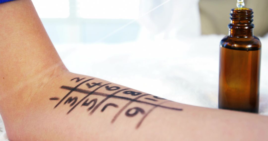 Forearm Showing Tic-Tac-Toe Marking Near Amber Dropper Bottle Suggesting Allergy Skin Test