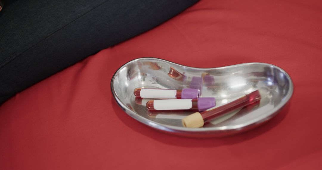 Blood Samples in Tray on Red Surface during Medical Procedure - Free Images, Stock Photos and Pictures on Pikwizard.com