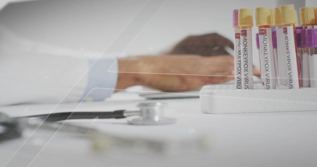 Monkeypox virus test tubes standing in rack on clinical desk with stethoscope and tablet