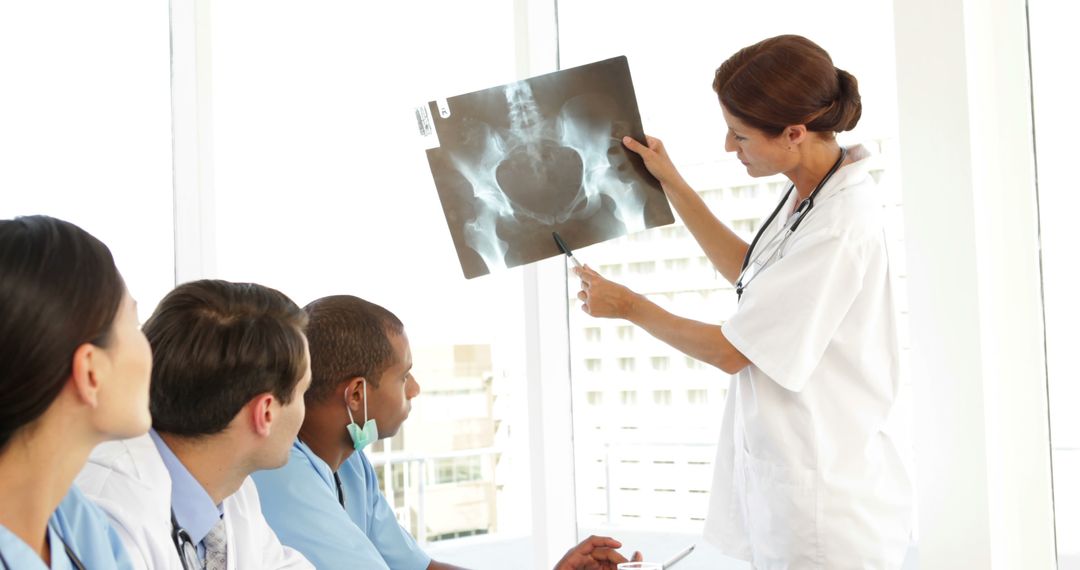 Medical team discussing an xray during meeting at the hospital - Free Images, Stock Photos and Pictures on Pikwizard.com