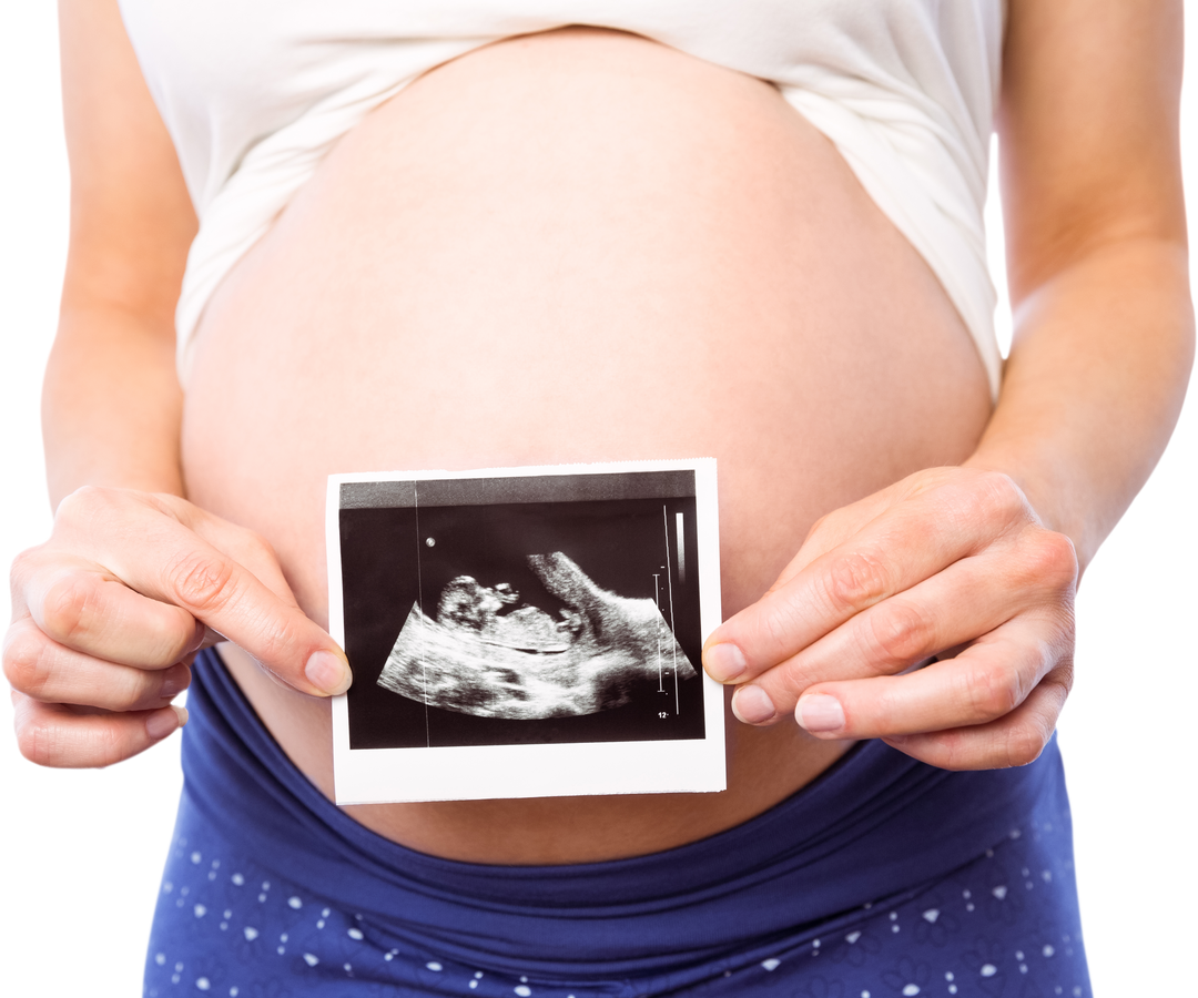 Pregnant Woman Holding Ultrasound Scan On Transparent Background - Download Free Stock Images Pikwizard.com