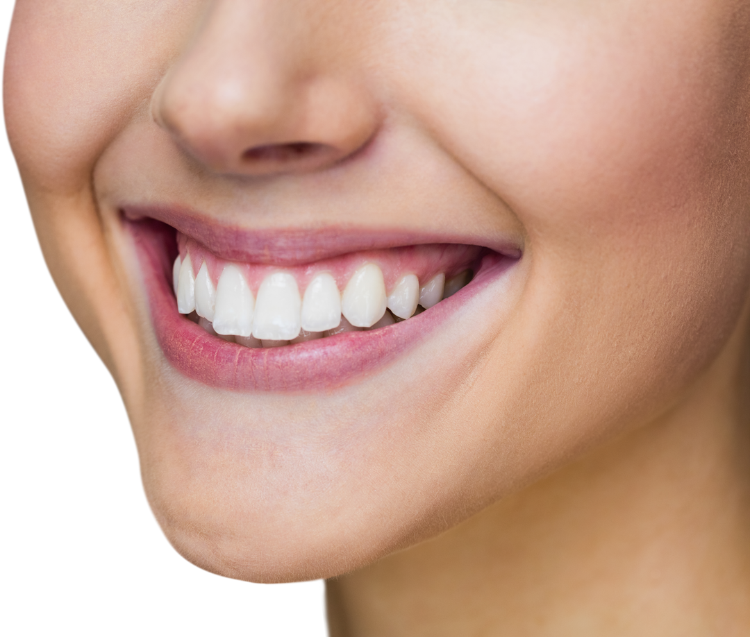 Closeup of Woman's Transparent Smile Highlighting White Teeth - Download Free Stock Images Pikwizard.com