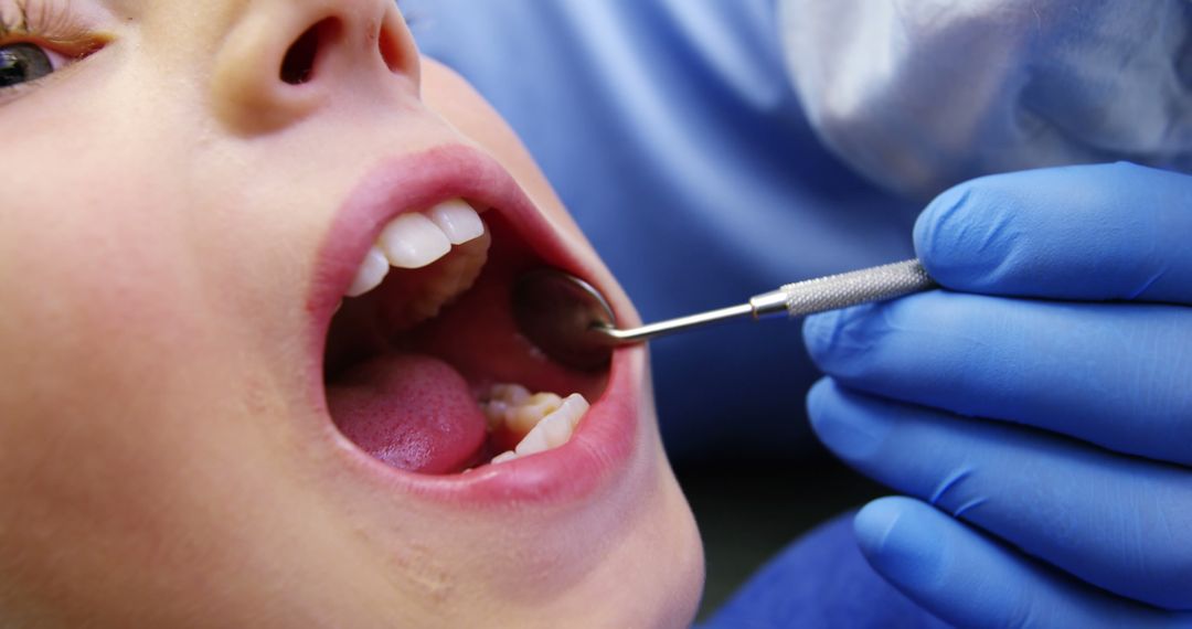 Child Receiving Dental Checkup Exam by Dentist - Free Images, Stock Photos and Pictures on Pikwizard.com