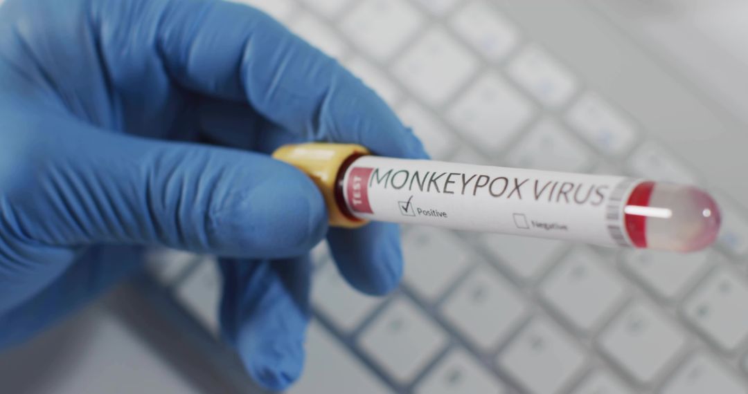 Gloved Hand Holding Monkeypox Positive Blood Specimen Tube with Yellow Cap on Lab Keyboard