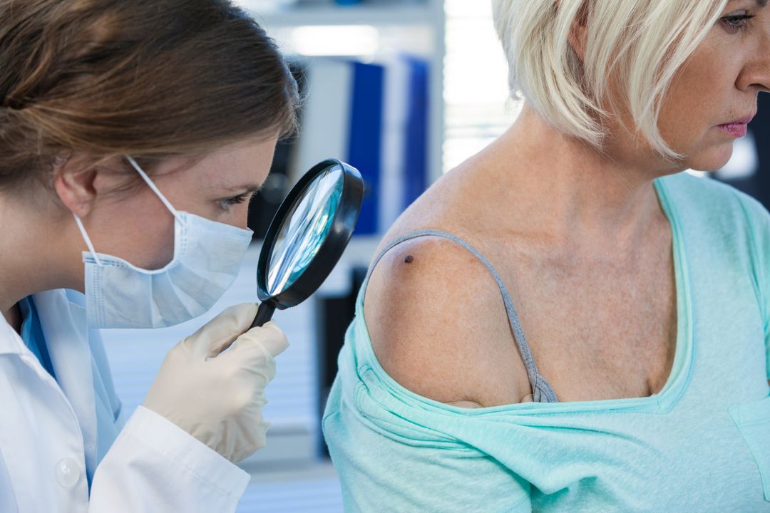 Dermatologist examining mole of female patient with magnifying glass - Free Images, Stock Photos and Pictures on Pikwizard.com