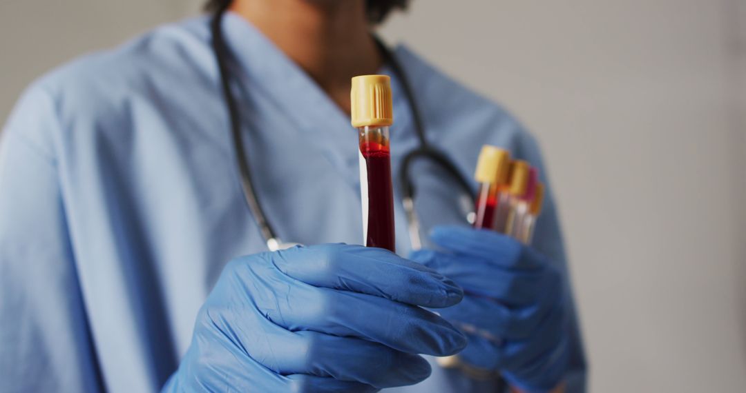 Medical Professional Holding Vials of Blood Samples - Free Images, Stock Photos and Pictures on Pikwizard.com