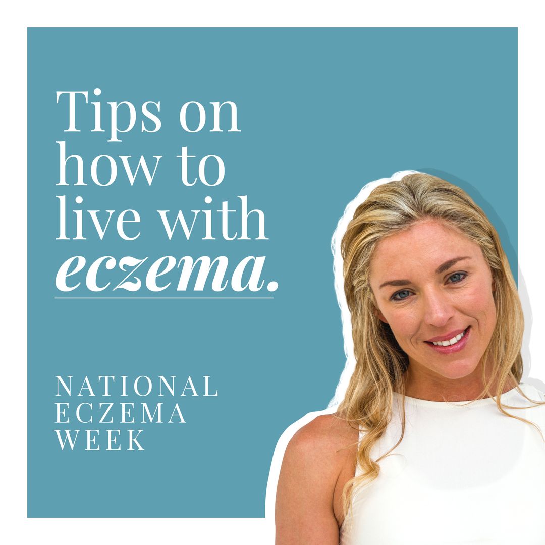 Raising Awareness During National Eczema Week with Practical Tips