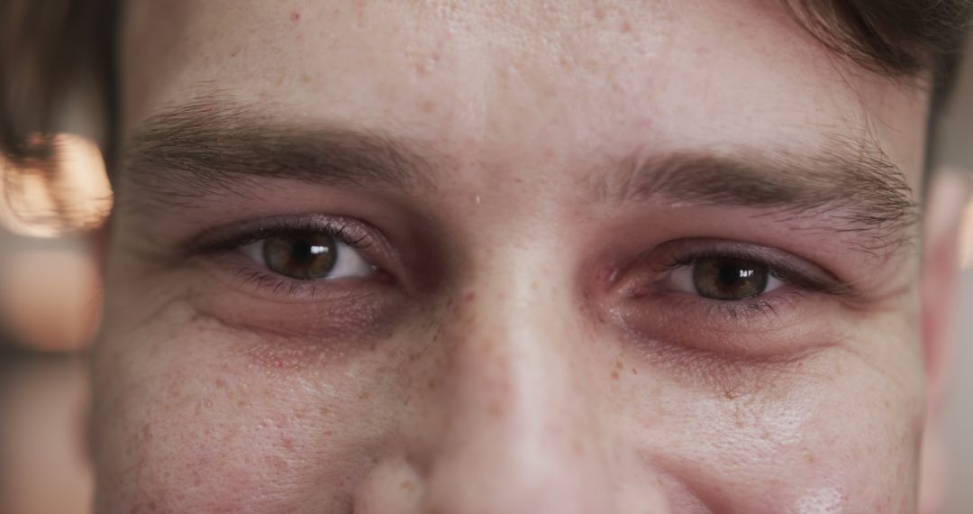 Close-Up of Young Man's Eyes with Natural Freckles and Smile Lines - Free Images, Stock Photos and Pictures on Pikwizard.com