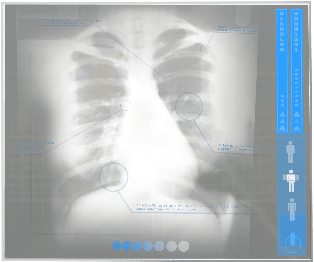 Transparent Digital Chest X-ray with Interactive Elements