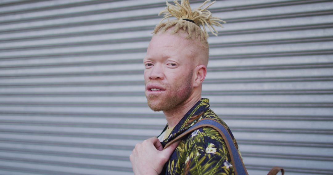 Albino Man with Dreadlocks Smiling at Camera in Urban Environment