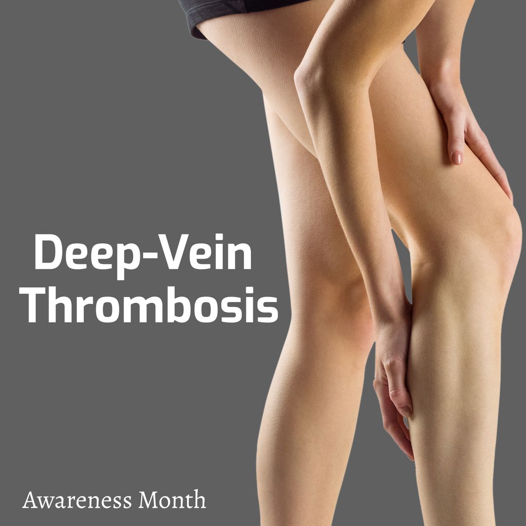 Promoting Awareness for Deep-Vein Thrombosis