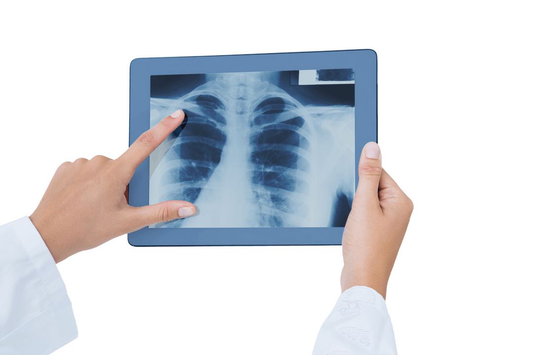 Doctor's Hand Holding Tablet with Lungs X-Ray on Transparent Background