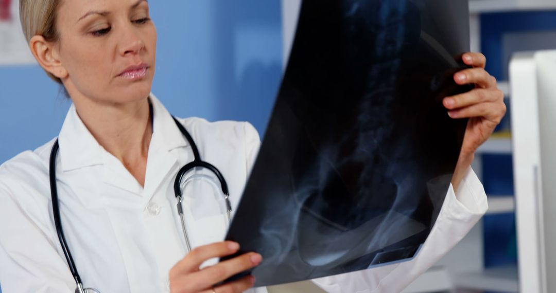 Female Doctor Examining X-ray in Hospital Office - Free Images, Stock Photos and Pictures on Pikwizard.com