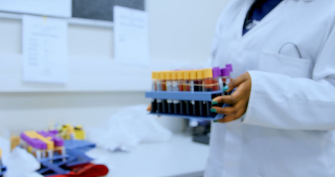 Scientist Holding Blood Samples in Laboratory - Free Images, Stock Photos and Pictures on Pikwizard.com