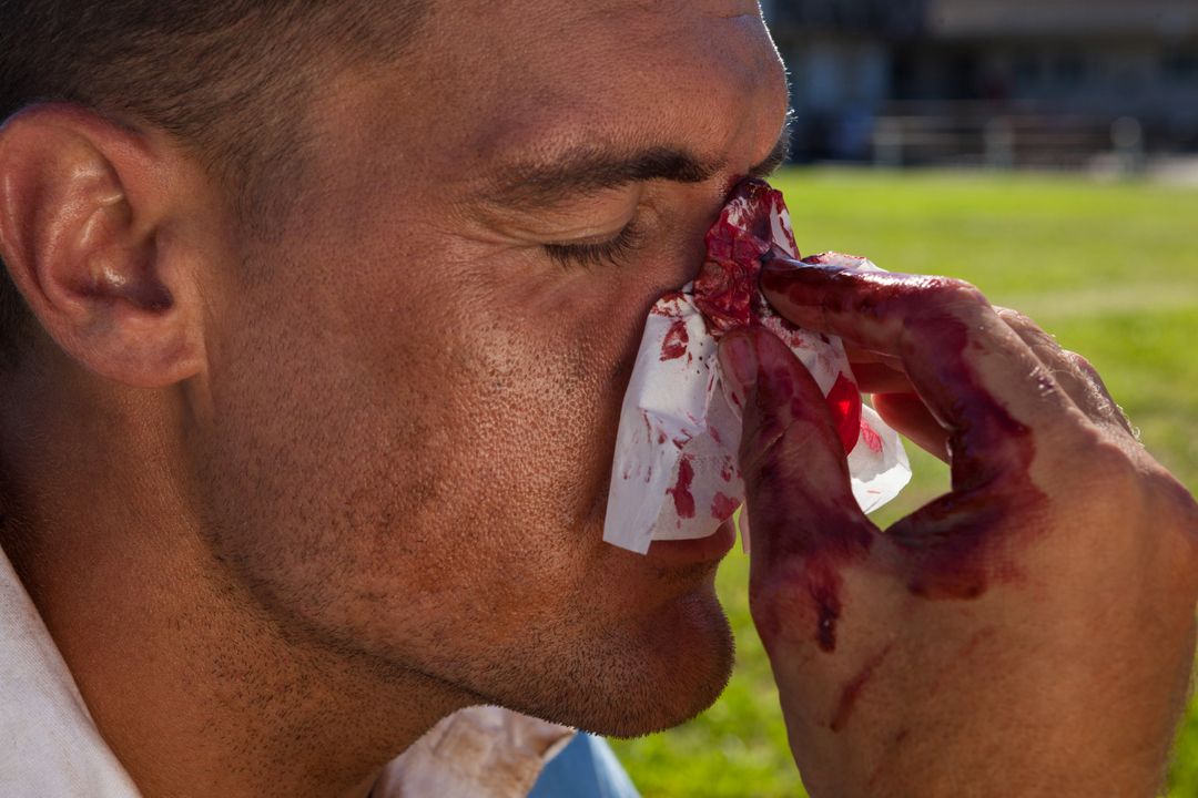 Close up of rugby player with injured nose - Free Images, Stock Photos and Pictures on Pikwizard.com
