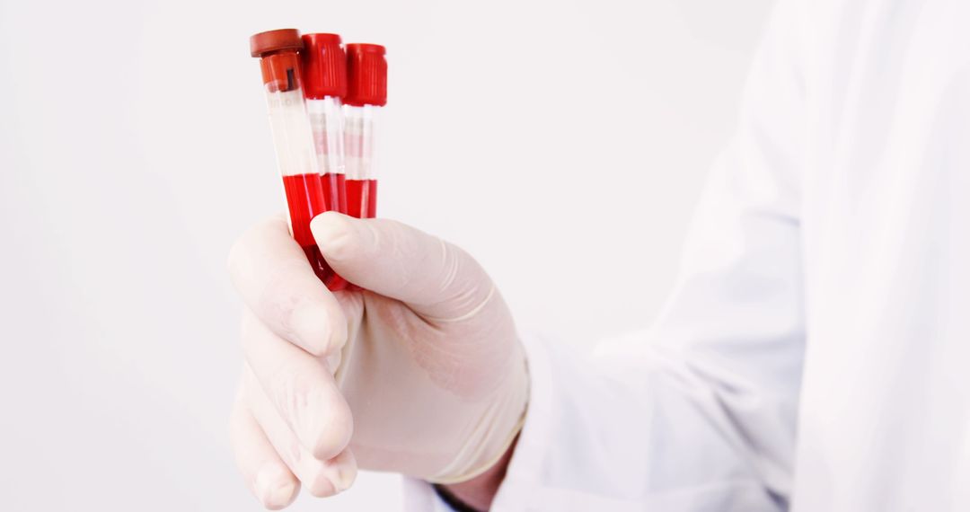 Lab Technician Holding Blood Samples in Test Tubes