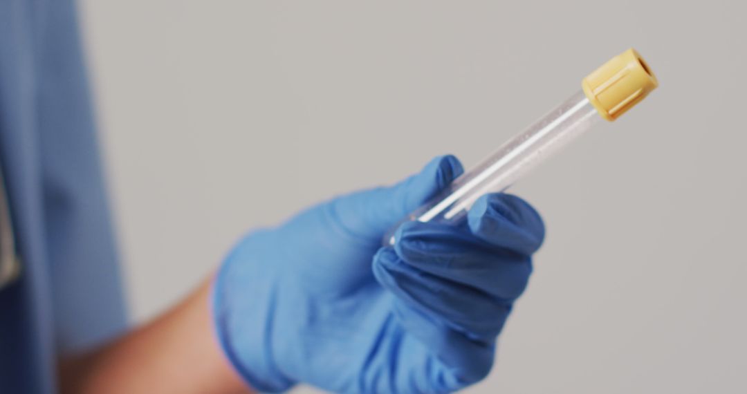 Image of biracial female doctor holding test tube on blue background - Free Images, Stock Photos and Pictures on Pikwizard.com