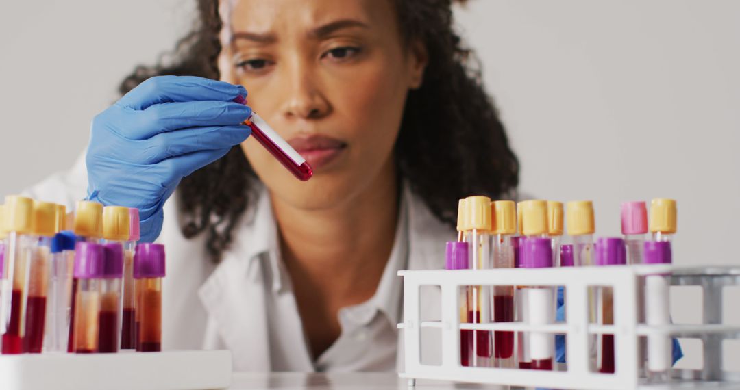 Scientist Analyzing Blood Samples in Laboratory - Free Images, Stock Photos and Pictures on Pikwizard.com