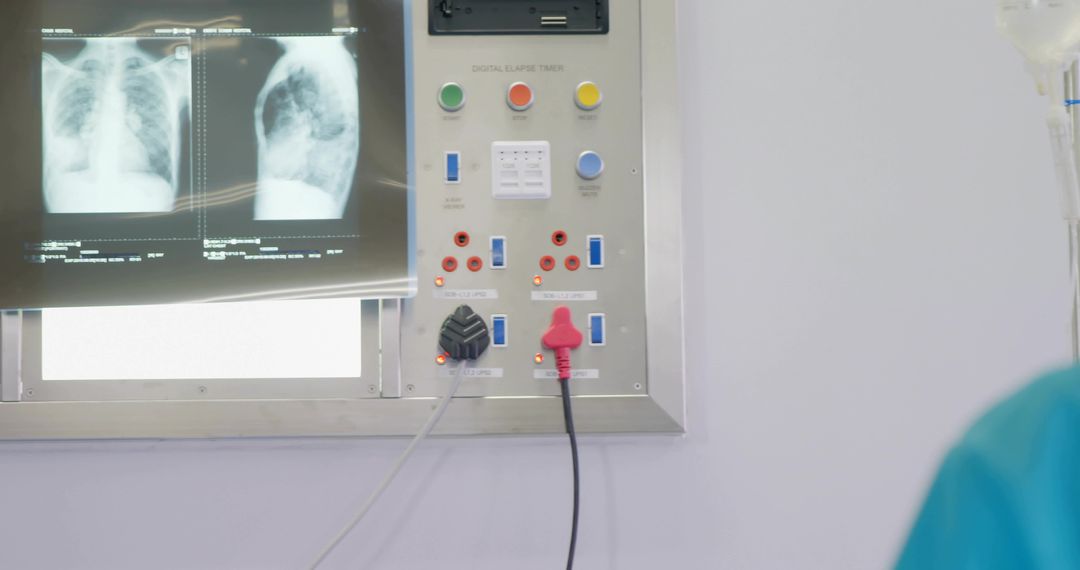 Displaying Chest X-Rays on Lightbox with Control Panel, IV Drip and Teal Scrubs