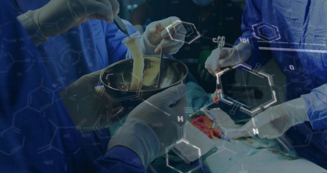 Precision Teamwork in Operating Room with Tissue Graft Preparation