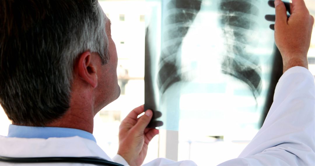 Doctor Examining Chest X-Ray in Medical Facility - Free Images, Stock Photos and Pictures on Pikwizard.com