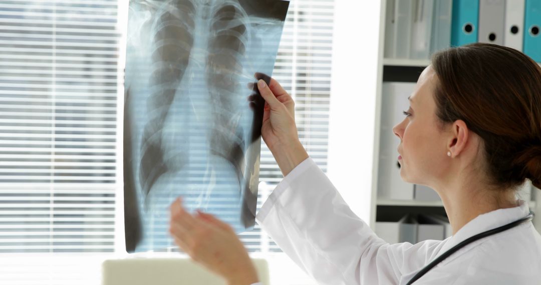 Doctor Examining Chest X-ray in Modern Medical Office - Free Images, Stock Photos and Pictures on Pikwizard.com