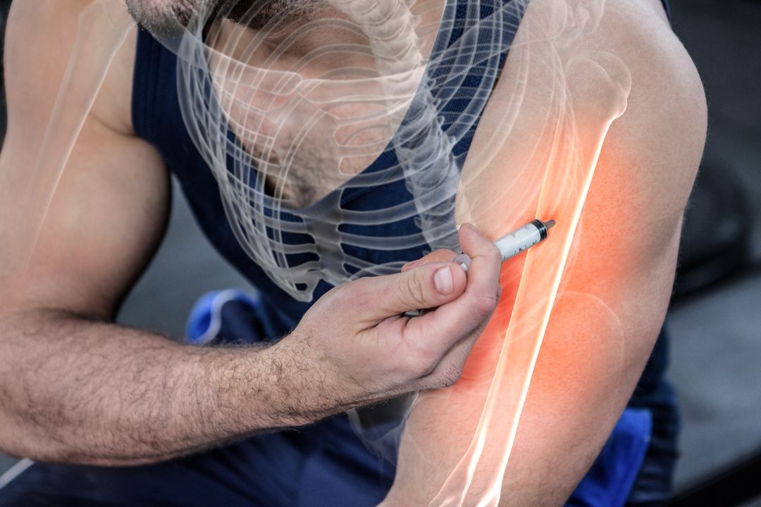 Man Injecting Anabolic Steroid into Highlighted Arm Muscles at Gym - Free Images, Stock Photos and Pictures on Pikwizard.com