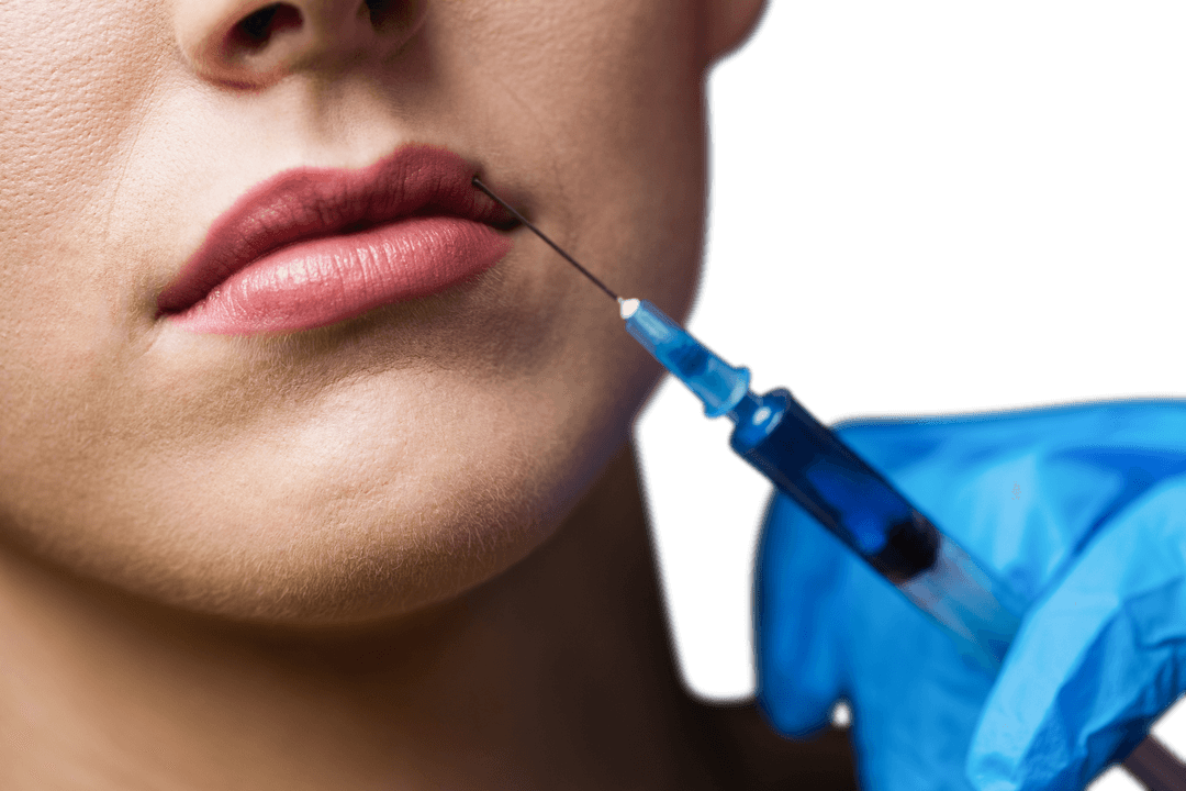 Woman Receiving Transparent Botox Injection on Lips in Room