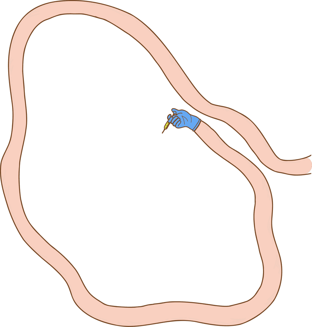 Modern Minimalist Drawing With Glove Dropper And Pink Loops On Transparent Background