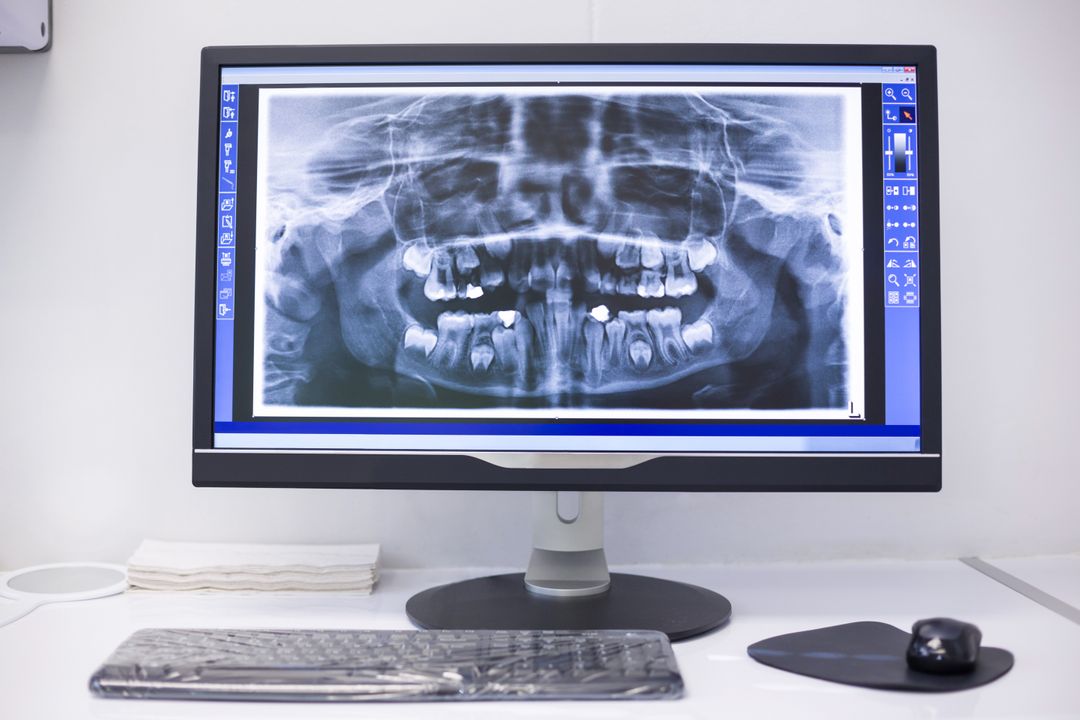 Dental X-Ray Displayed on Monitor in Clinic - Free Images, Stock Photos and Pictures on Pikwizard.com