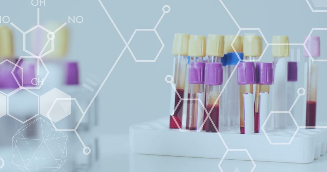 Digital Interfaces Concept in Global Medicine with Test Tubes