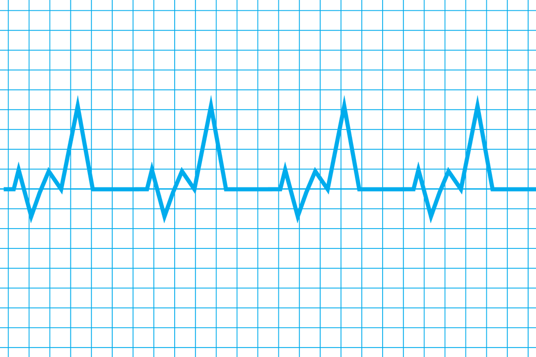 Heartbeat Pattern on Transparent Background for Medical Design