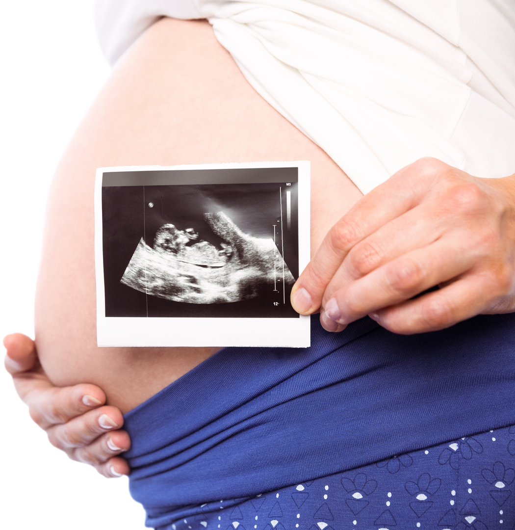 Pregnant Woman Holding Ultrasound Scan Against Bare Baby Bump - Transparent Background - Download Free Stock Images Pikwizard.com