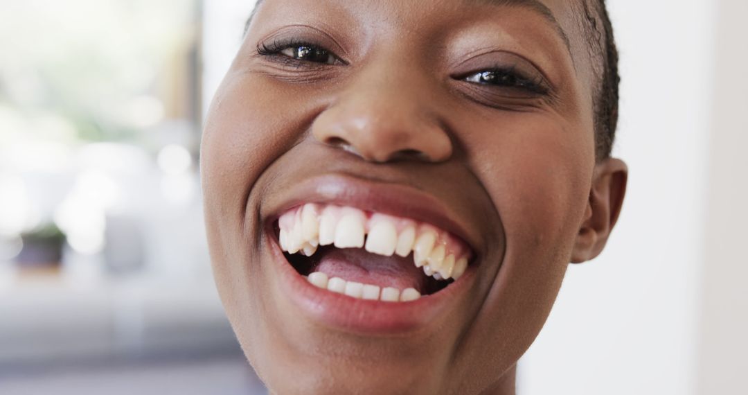 Close-up of Smiling Young African American Woman Showing Teeth - Free Images, Stock Photos and Pictures on Pikwizard.com