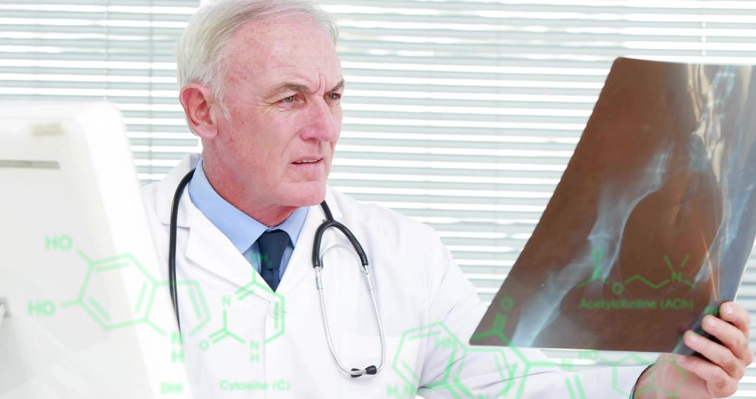 Senior Doctor Holding Hip X-Ray and Analyzing Results with Stethoscope and Medical Graphics