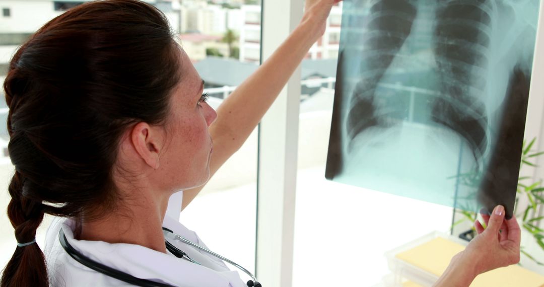 Female Doctor Examining Chest X-ray in Hospital - Free Images, Stock Photos and Pictures on Pikwizard.com