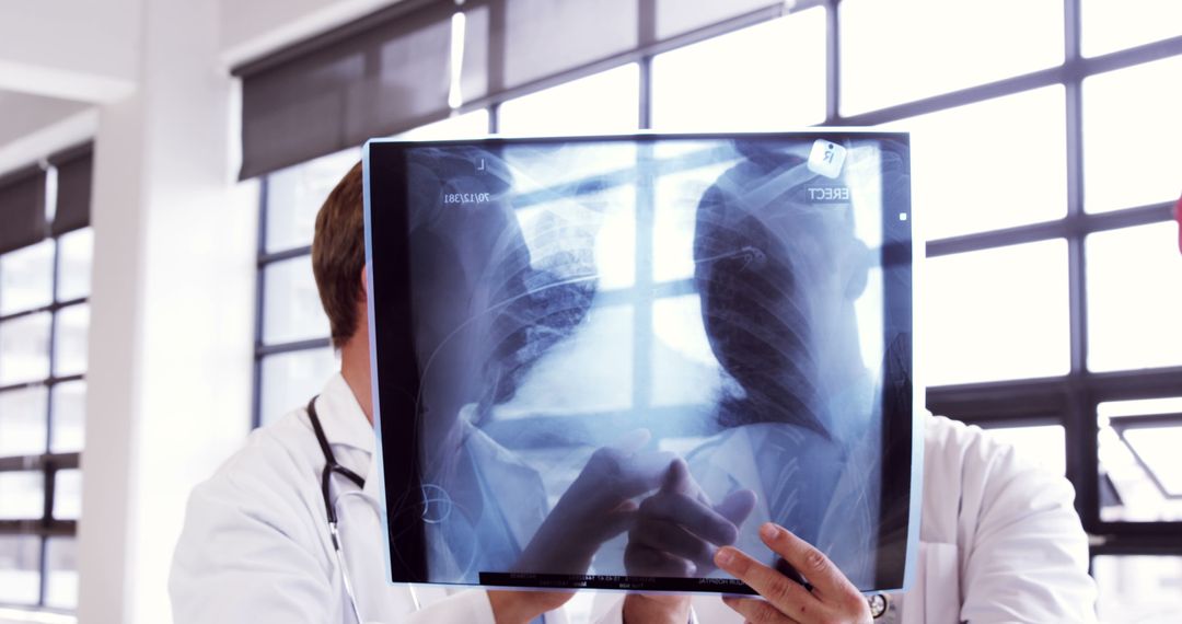 Doctors Examining Chest X-ray in Hospital - Free Images, Stock Photos and Pictures on Pikwizard.com