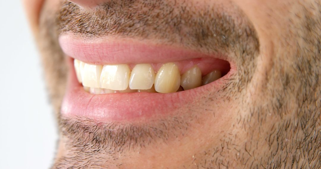 Close-Up of Man Smiling Showing Healthy White Teeth - Free Images, Stock Photos and Pictures on Pikwizard.com