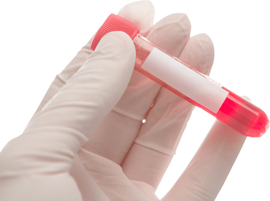 Transparent Medical Gloved Hand Holding Red Test Tube