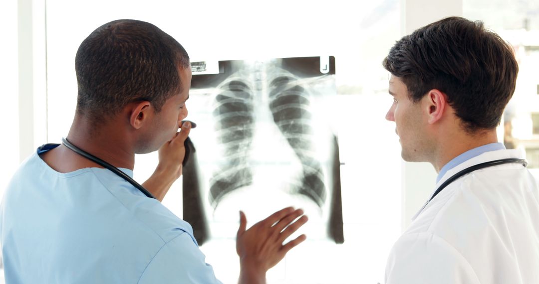 Medical Professionals Analyzing Chest X-Ray in Modern Hospital - Free Images, Stock Photos and Pictures on Pikwizard.com