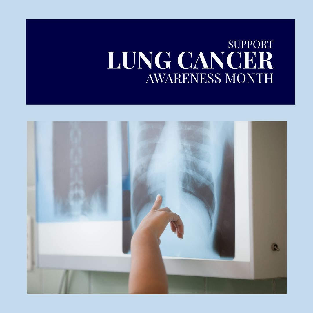 Lung Cancer Awareness Month with Doctor Analyzing X-Ray